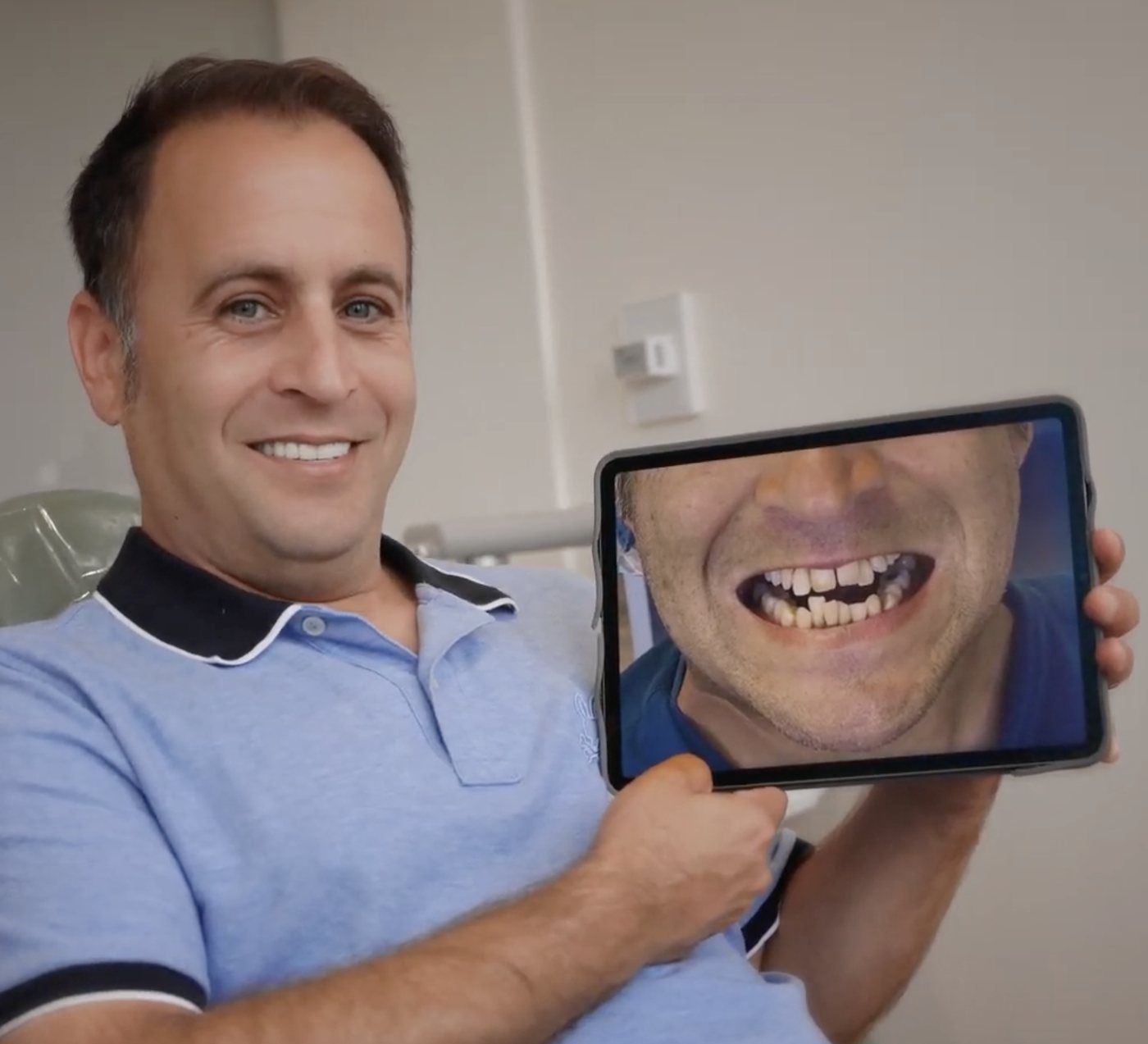 Jordan smiling in the dental chair, holding a tablet that shows his smile before treatment.