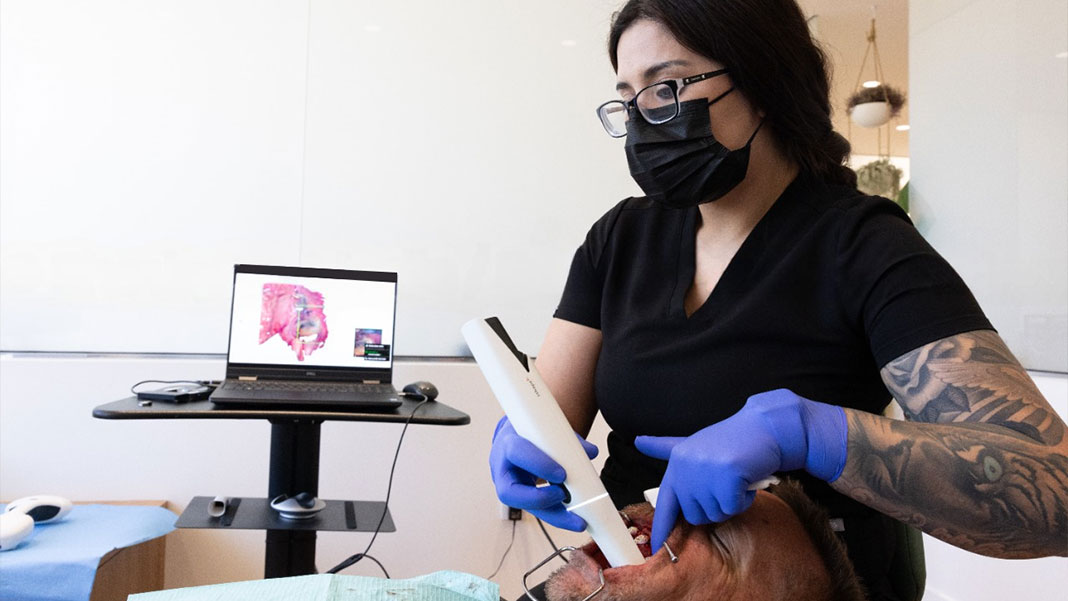 3-D Scanning