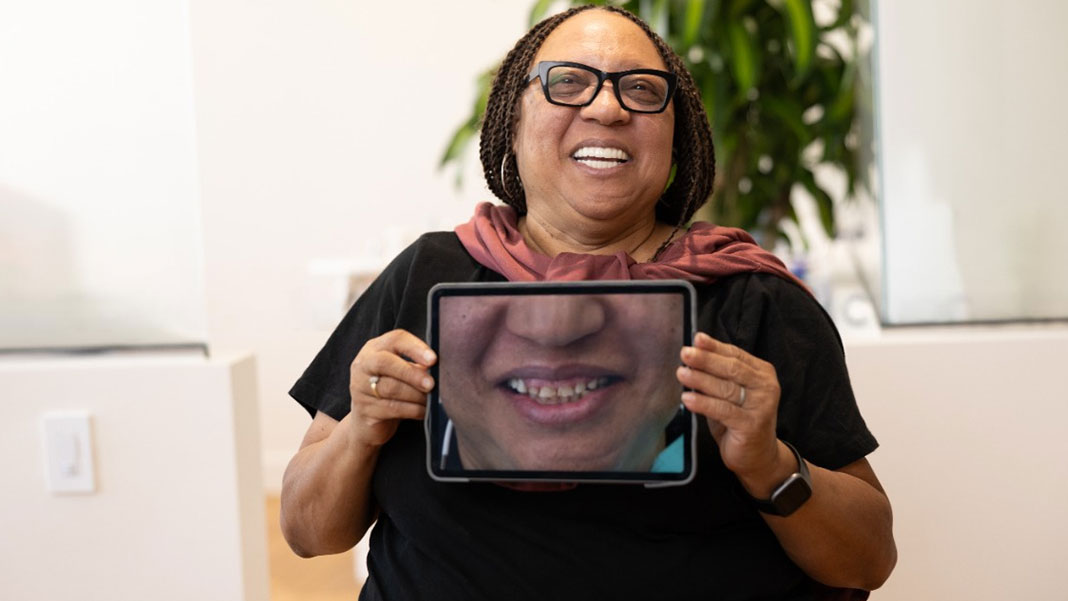 Smile Makeover